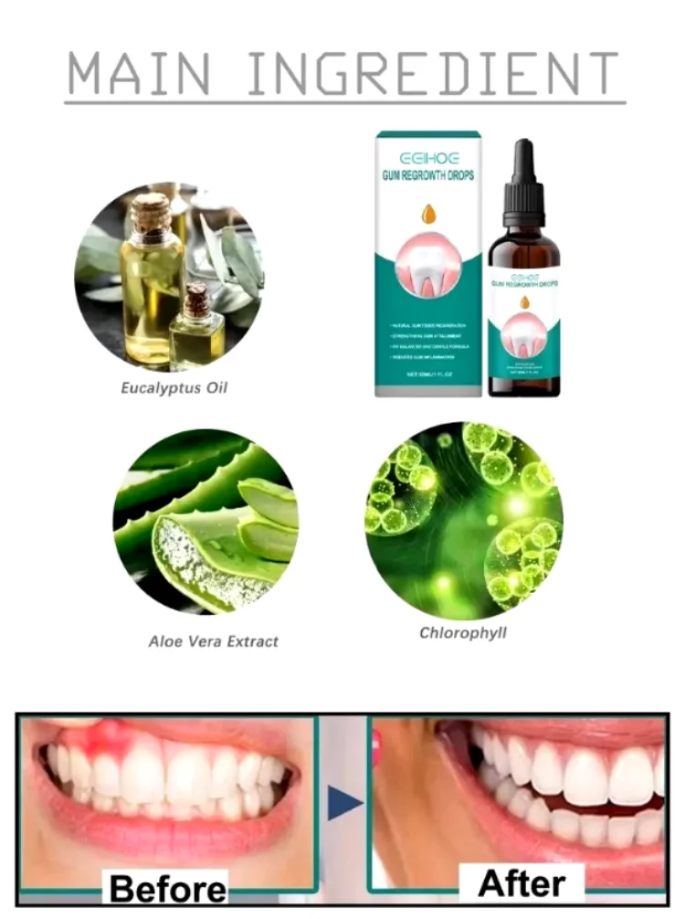 Gum Repair Drops Relieve Receding Gingival Swelling Gum Cleaning Care Oral Periodontal Hygiene Remove Stain Remove Yellow Tartar