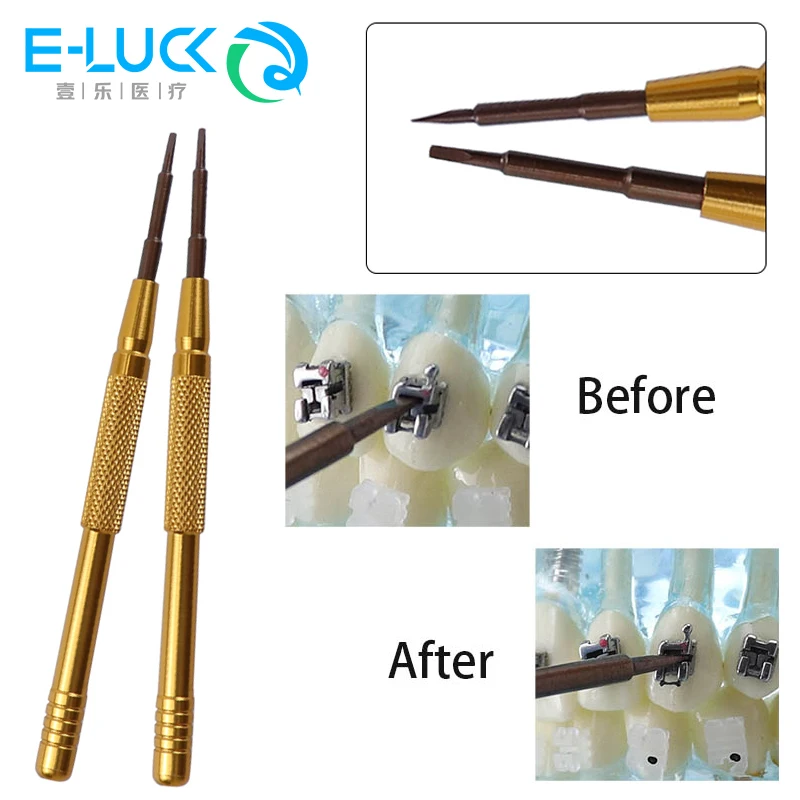 

Инструмент для открывания стоматологических инструментов, ортодонтический открывающийся самокронштейн из нержавеющей стали для самоделирующегося кронштейна, скоба