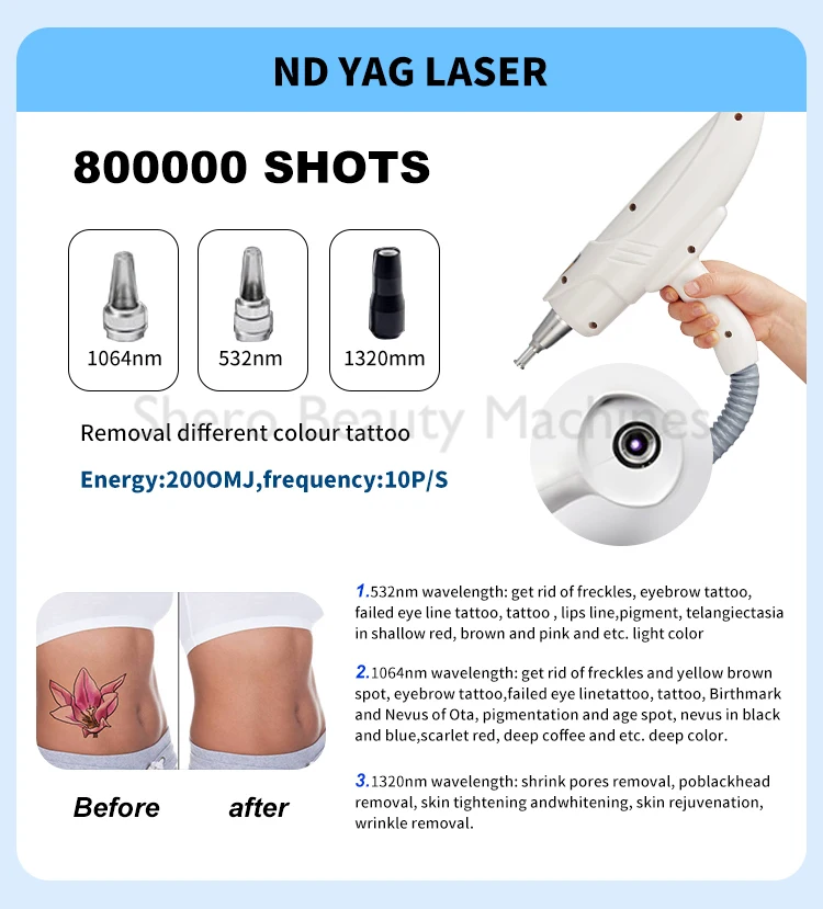 360 مغناطيسي Elight OPT مقبض إزالة الشعر M22 مقبض تجديد الجلد Nd Yag مقبض لملحقات آلة إزالة الشعر إزالة الوشم #5