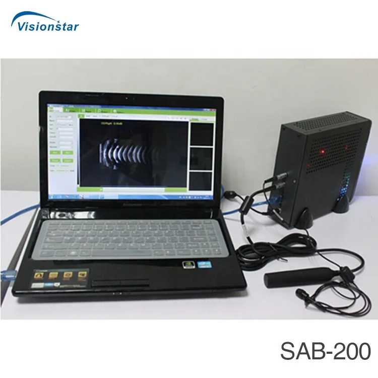 SAB-200 China Low Price Ophthalmic AB Scan for  Examination