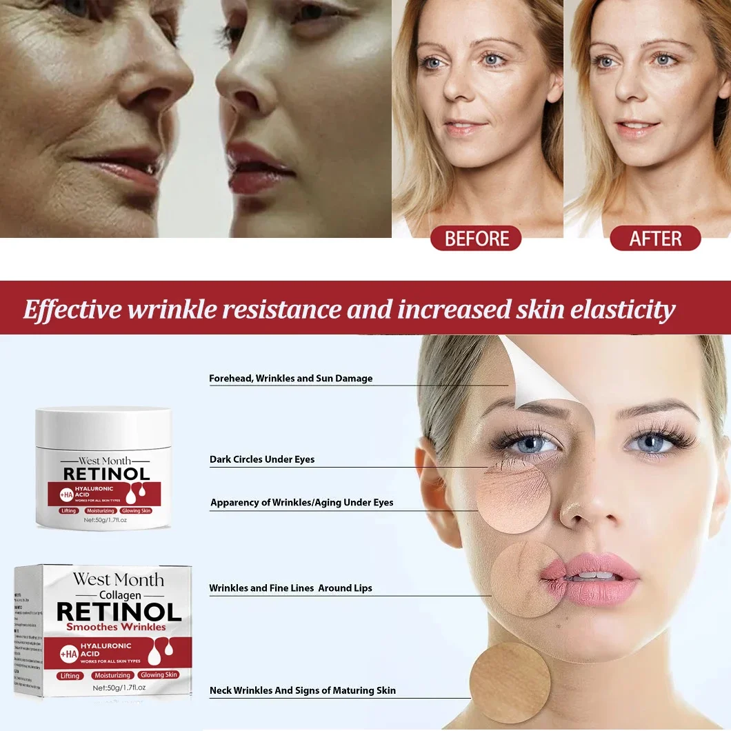 Retinol Rimpel Verwijderaar Gezichtscrème Verstevigende Lifting Anti Veroudering Vervagen Fijne Lijntjes Hydraterende Whitening Huidverzorgingsproduct Cosmetisch