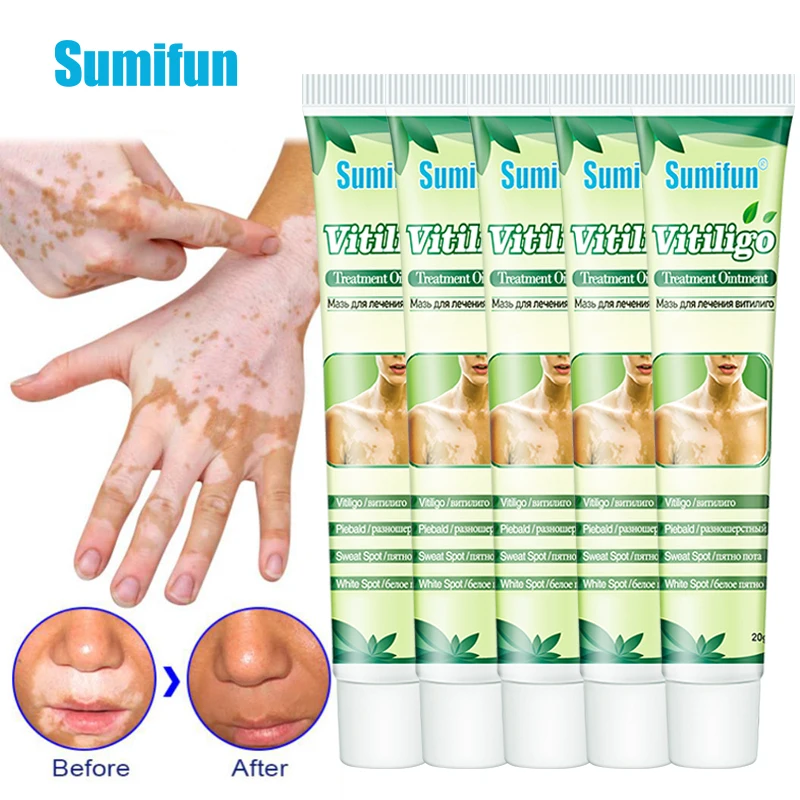 

Sumifun 5pcs Medical Vitiligo Treatment Cream Remove White Spot Promote Melanin Production Herbal Vitiligo Skin Health Care 20g