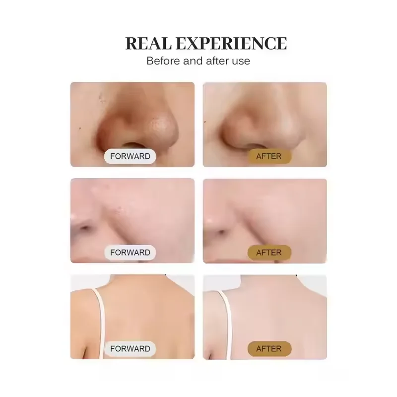 Diamond Dermabrasion Machine Skin Whitening Rejuvenation Facial Beauty Device for Acne Treatment with Oxygen Bubble Function