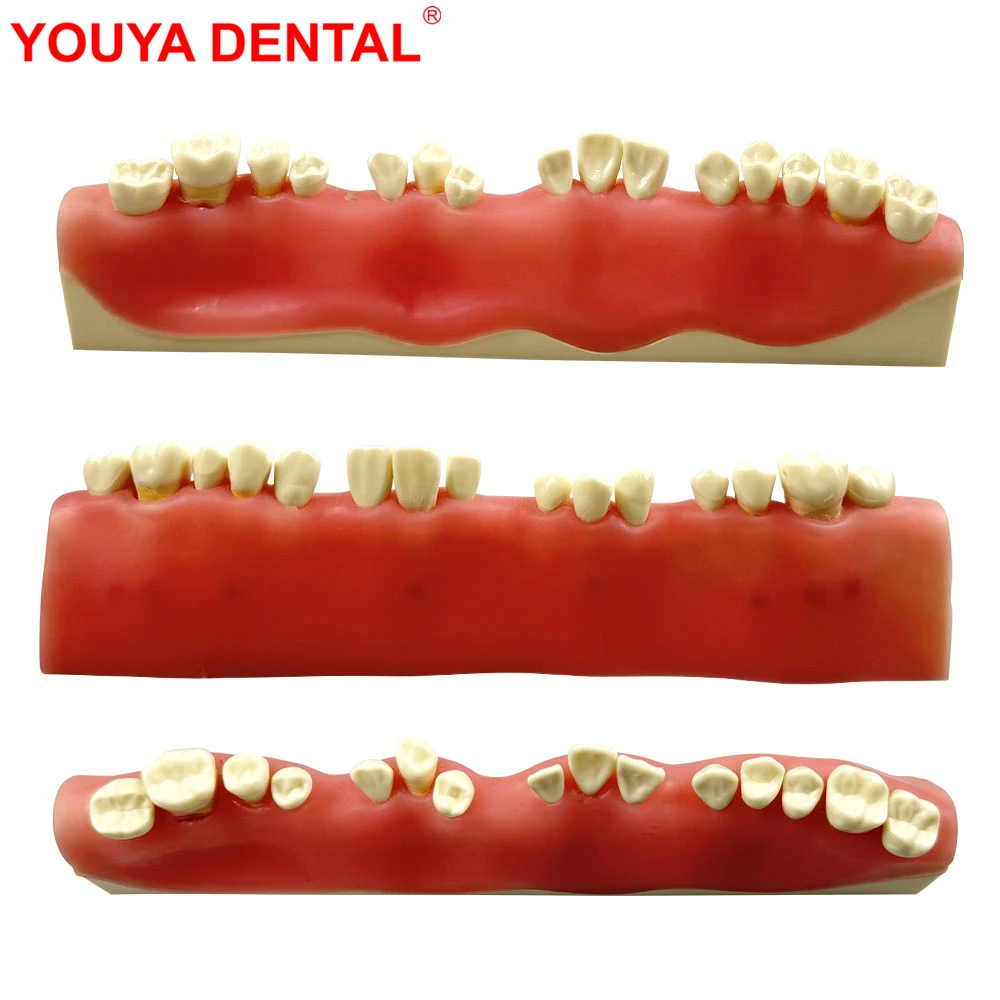 

Модель для стоматологической подготовки, модель корня абсссы, модель для практики, модели экзаменации апкокоэтомии для обучения стоматолога, пациента, образования, демонстрации