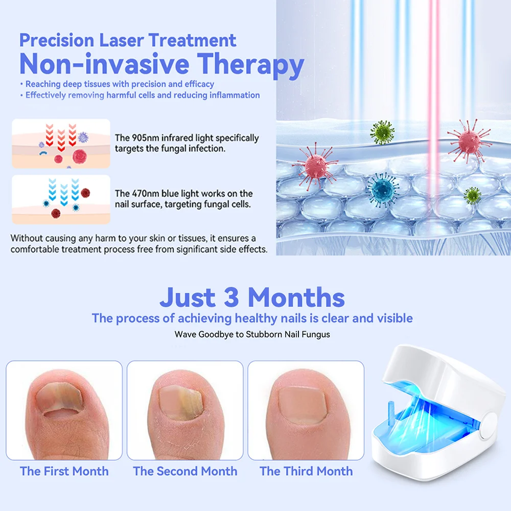 أداة مساعدة الأظافر الرمادية المحمولة ، جهاز ليزر لتنظيف الفطريات بالأشعة تحت البنفسجية احترافي للأظافر ، مصباح علاج ضوئي ، شحن من النوع C ، بالجملة