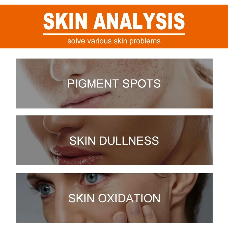 Spot Removing Essence Moisturizing Fade Melasma Freckles Stain Remover Removal Melaninskin Whitening Brighten Freckle Essence