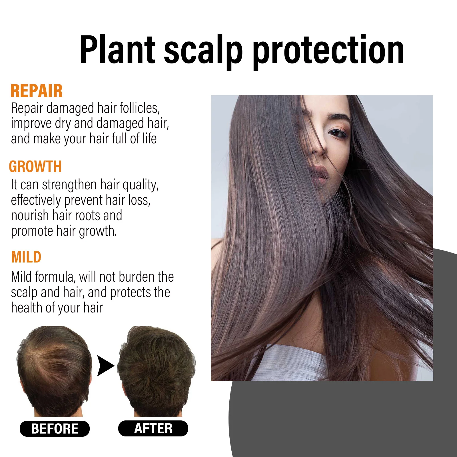 비오틴 모발 성장 스프레이 안티 비듬 가려움증 치료 건조 곱슬 머리 영양 두피 손상된 수리 세럼 헤어 케어 에센셜 오일