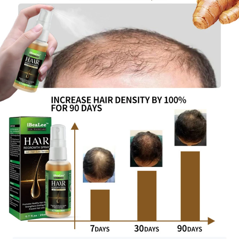 

Ginger Essence Hairdressing Essential Oil Scalp Treatment Prevent Hair Loss Liquid Hair Care Serum Oil Hair Growth