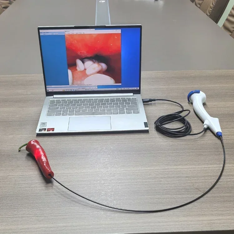 Customized Durable Hospital Medical Portable Video Gastroscope Endoscope Camera Pet Endoscope