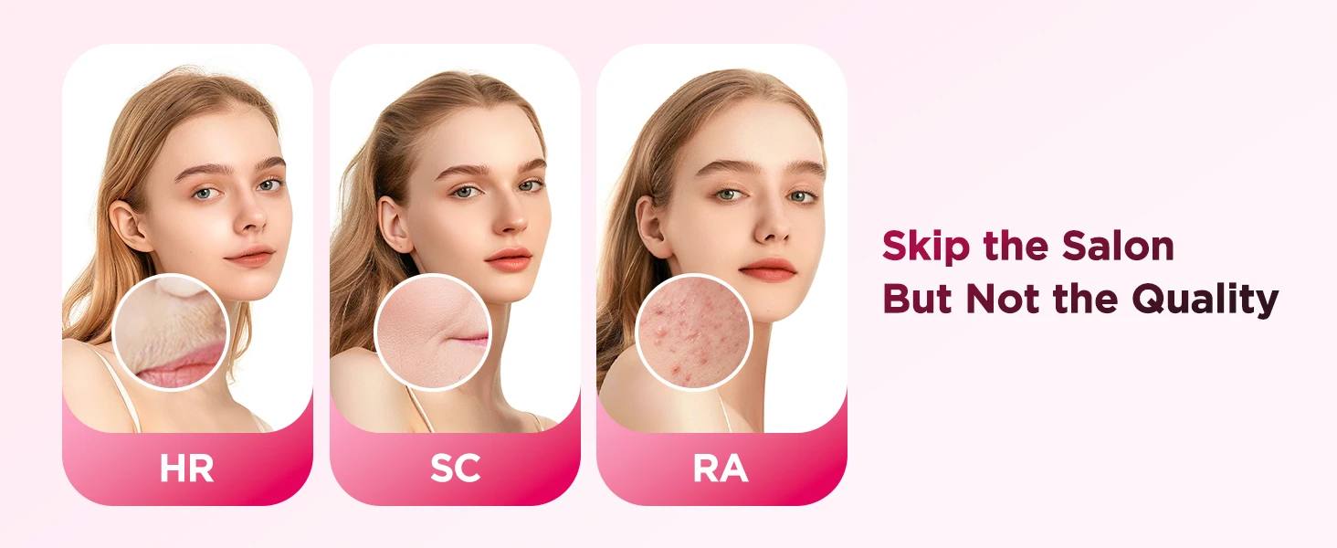 990.000 Flash-Laser-Epilierer, IPL-Haarentfernung für Männer und Frauen, Körper, Bikini, Gesichtsdauerhafte, schmerzfreie IPL-Haarentfernungsmaschine – Detail 7