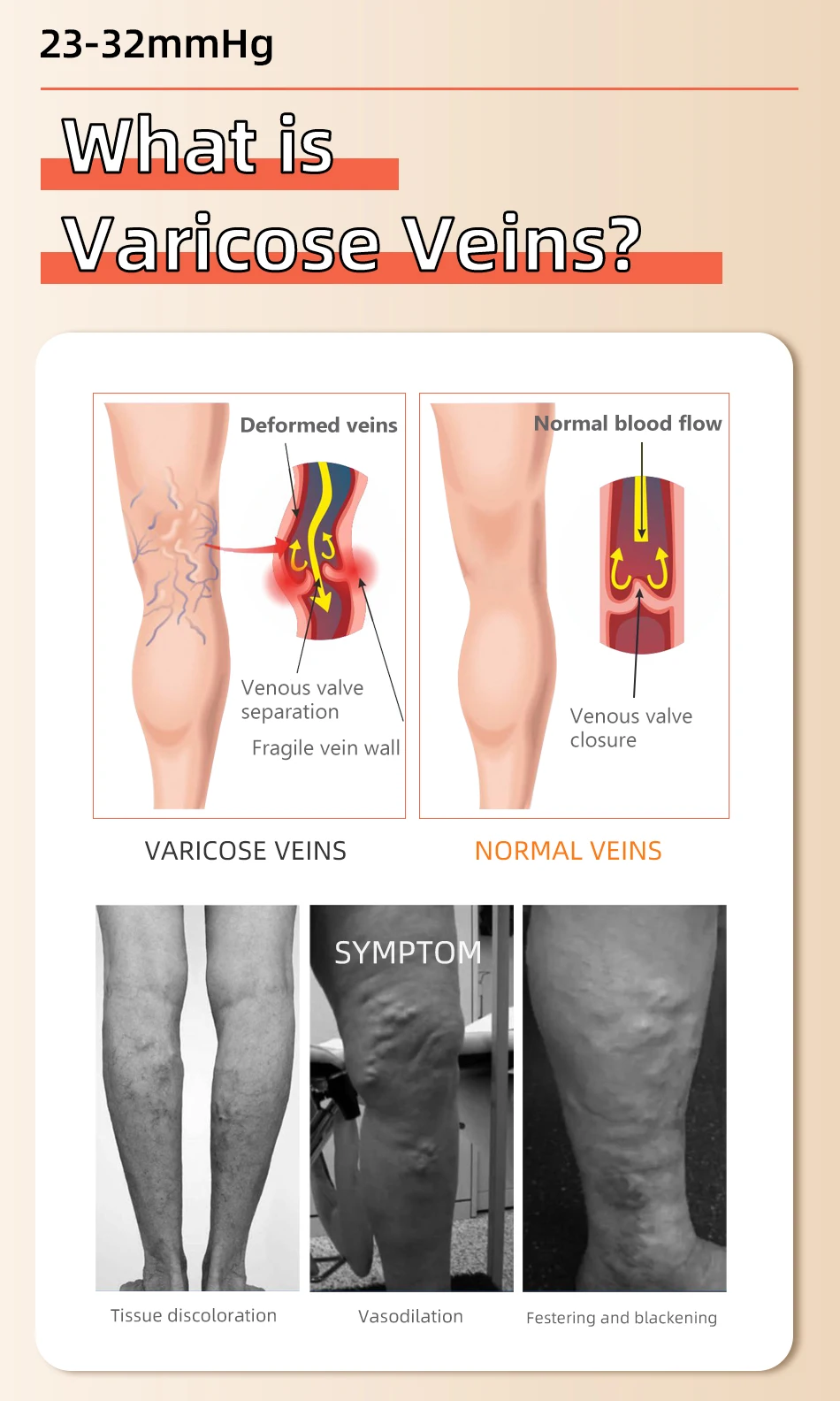 Legbeauty Plus Size Medizinische Kompressions-Wadensocke Unisex Sport-Wadenstützhülle Fußlos 23-32mmHg Krampfader-Strumpf – Detail 8