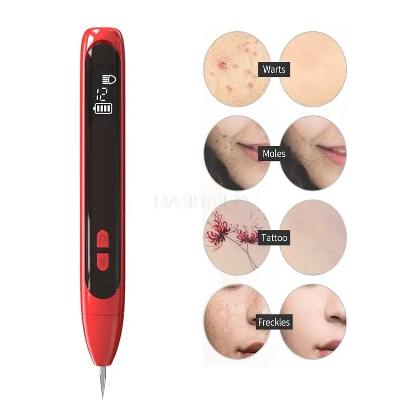 12 point nevus spot pen nevus remover black nevus scanning pen eyebrow washing machine repair cream no mark facial beauty pen