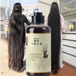 300ml Africa Women Traction Alopecia Treatment Hair Growth Product for Men Shampoo Hair Loss Treatment Get Rid of Wigs