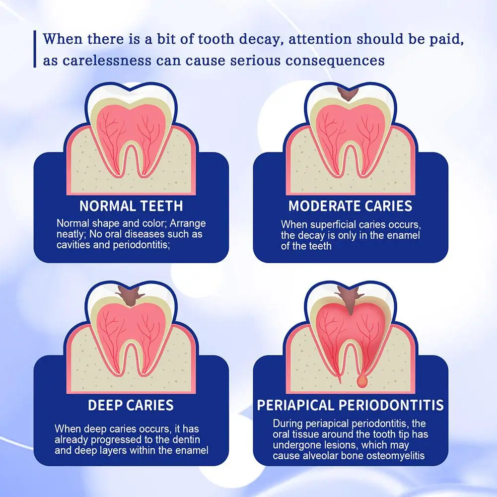 Réparation du blanchiment des dents, 1 à 8 pièces, carie dentaire, mauvaise haleine fraîche, anti-carie, élimination de la plaque dentaire, parodontite