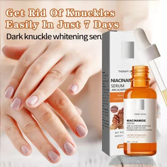 

Dark Knuckles Fast Whitening Serum Hand Knuckle Elbows Knee Melanin Corrector Intense Stains Remover Products Beauty Care