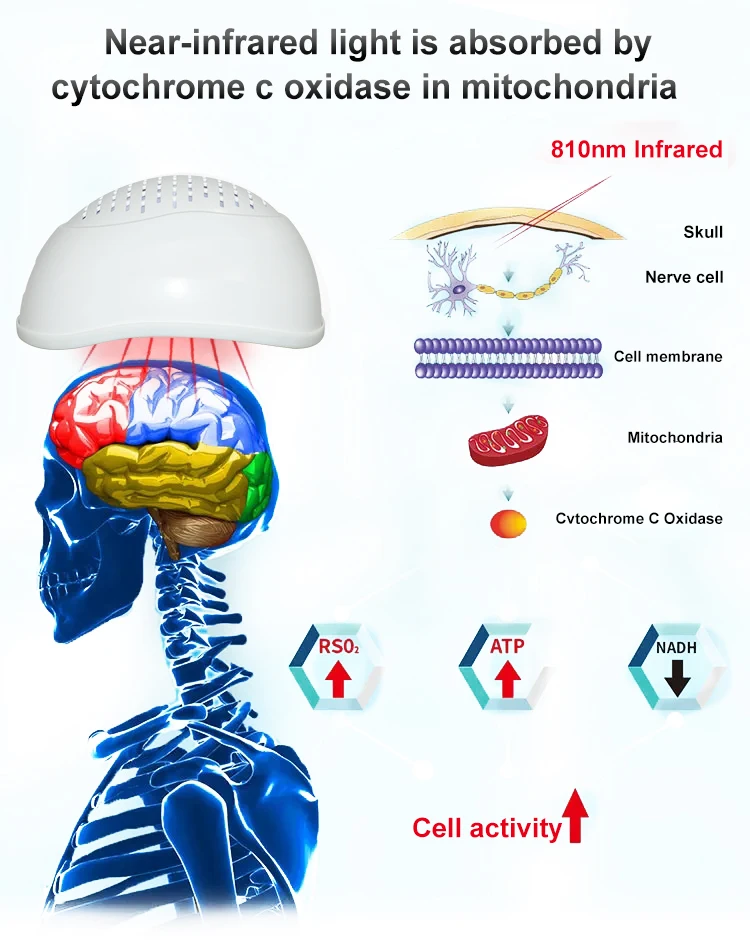 ZJZK 15W Aphasia Neuro Brain Helmet Gifts 810nmx280diodes For Dementia Patients Women Post Traumatic Stress Disorder Anxiety