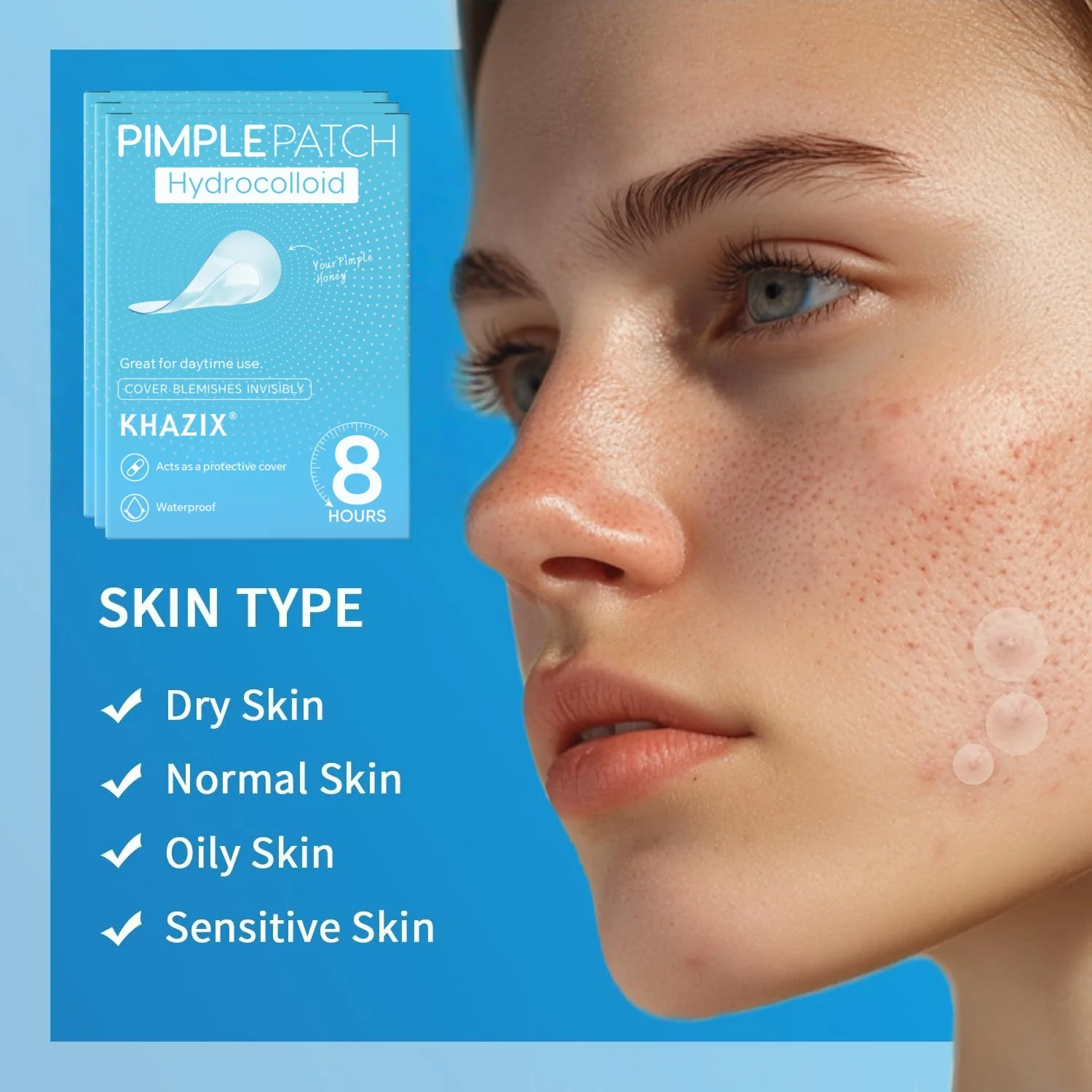 Parches para acné, pegatinas para cubrir el acné, parches hidrocoloides para el acné, pegatinas para manchas de luz para la cara y la piel, cuidado de la piel facial