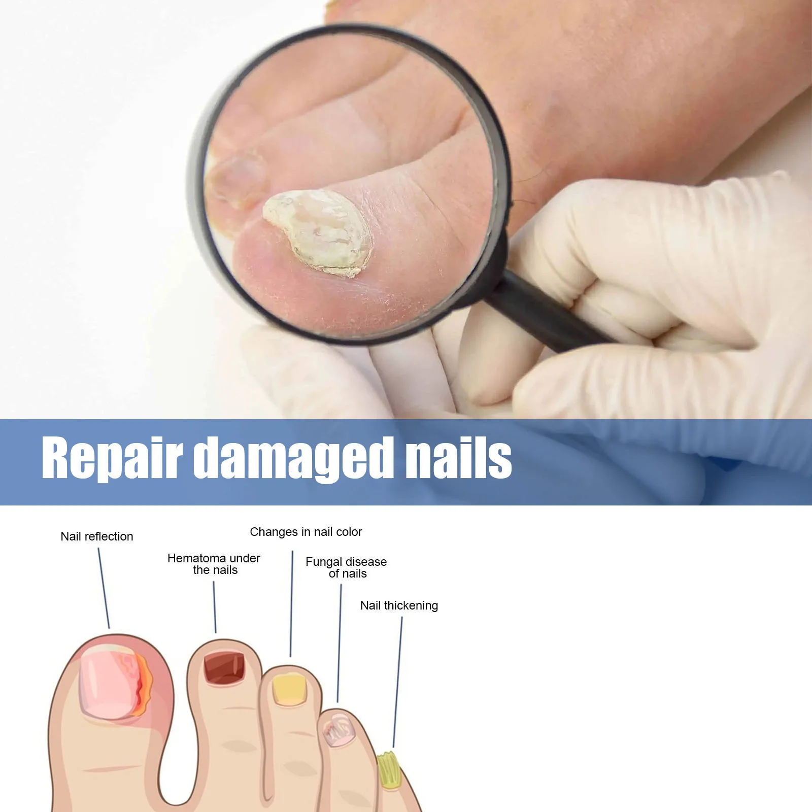 Remendo de tratamento de unhas nutre profundamente repara unhas danificadas unhas fungas cinza espessamento macio paroníquia tratamento adesivos