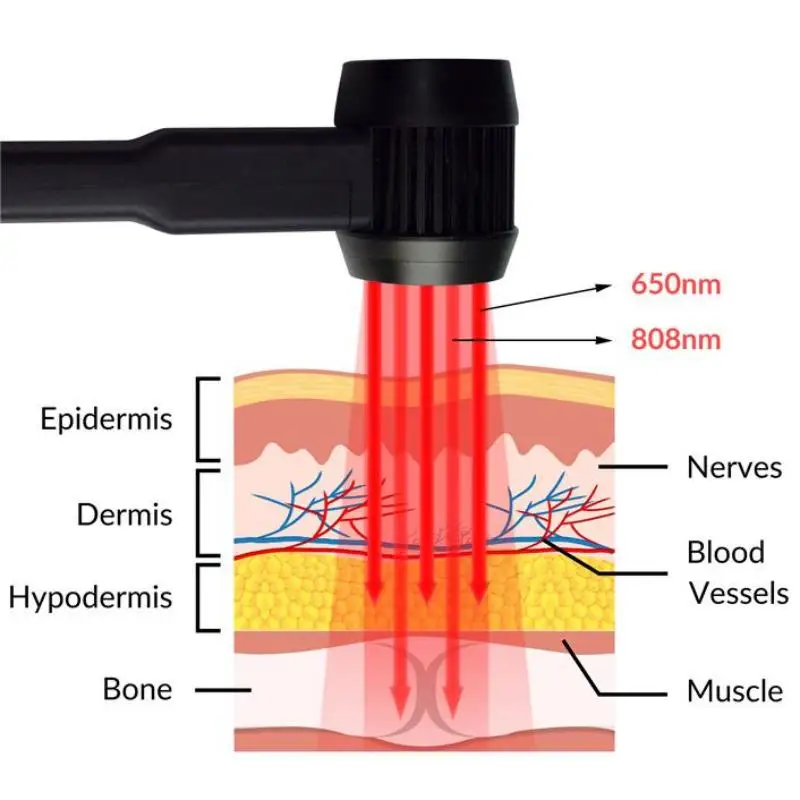 ZJZK 650nm 808nm Harga terapi laser level rendah genggam untuk terowongan karpal 8w trigeminal neurgia hip atau bursitis bahu