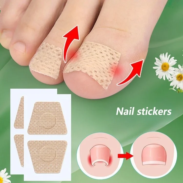 Toenail Fungus Patch Nail Repair Patches Nail Ingrown Correction Stickers For Discolored Damaged Nails Sticker Toenail Care