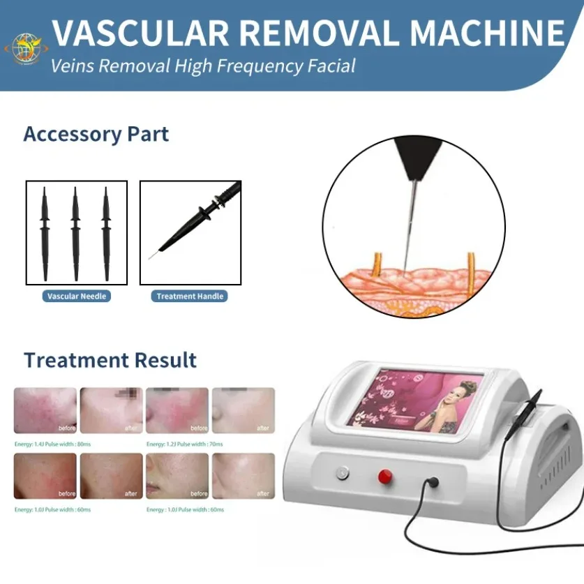 Laser System Cheap R-F High Frequency Vascular Therapy Machine Red Blood Vessels Spider Vein Removal R-F