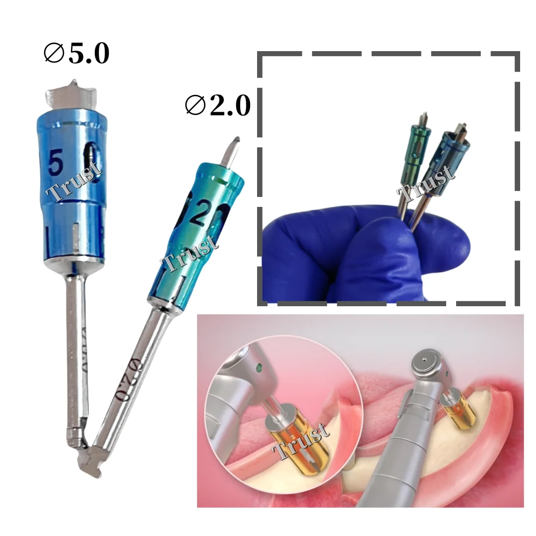 2Pcs/Set Dental Never Loss Bone Collector Drills Implant Stopper Self Bone Powder Harvest 2.0/5.0mm