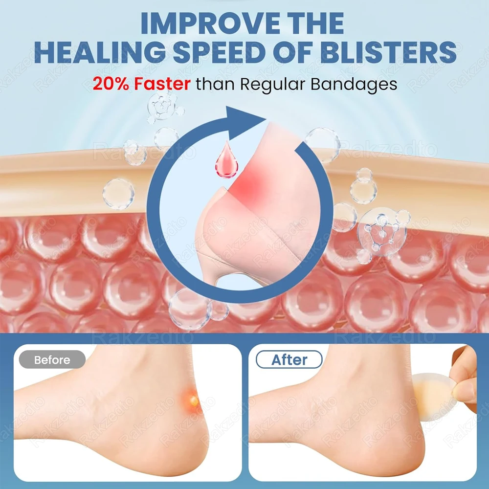 10Pcs Silicone Heel Protectors Anti-Wear Foot Pain Patches Self-Adhesive Blister Stickers Hydrocolloid Plaster Gel Heel Stickers