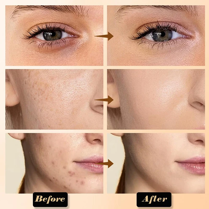Paleta de crema correctora de 8 colores, maquillaje de contorno mate, paleta todo en uno que cubre profesionalmente las ojeras alrededor de los ojos