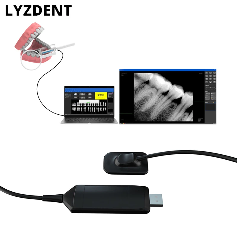 Digital Cameras Dentistry Dental X-Ray Sensor High-Frequency Rx Digital Intraoral Digital System H D Image Radiovisografo Tools