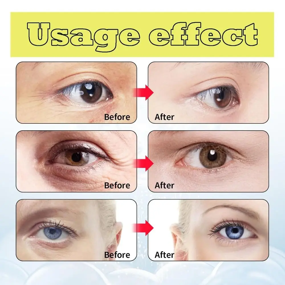 Anti-Aging Retinol Tightening Serum 9-Peptide Complex Panthenol Wrinkle Reduction Eye Firming Cream with 0.1% Retinol