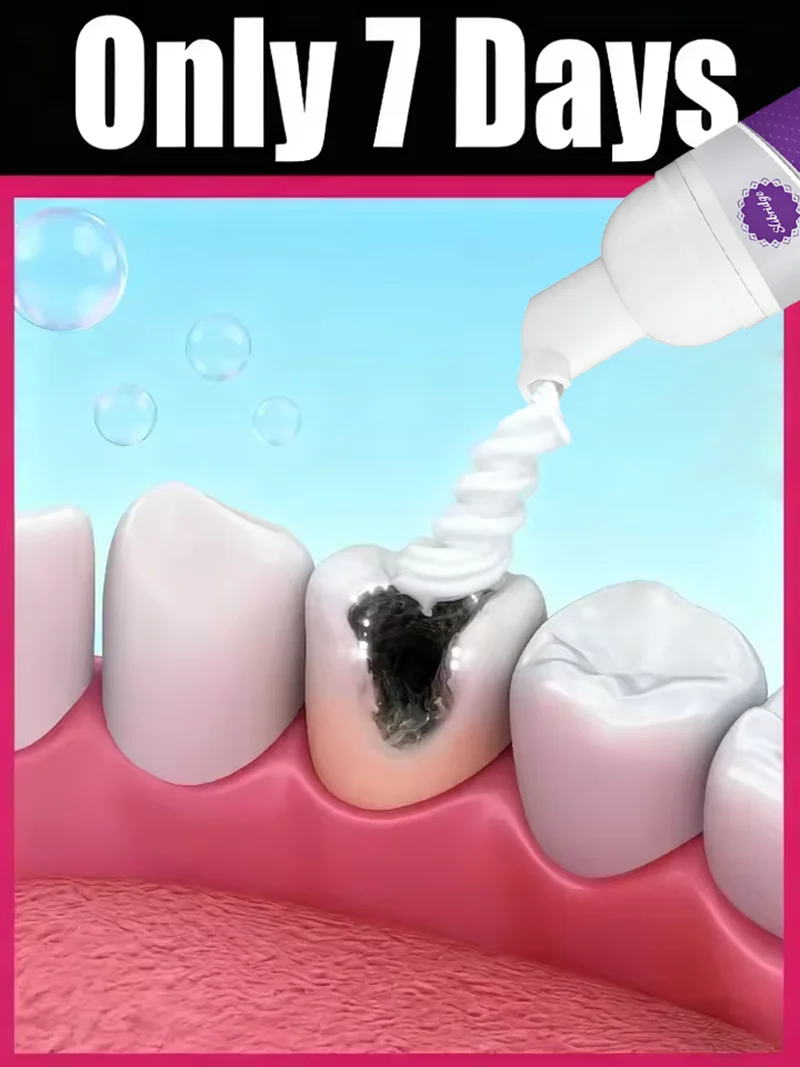 Tooth decay Repair Repair all cavities, protect teeth remove plaque stains Tooth decay repair teeth whitening Dental