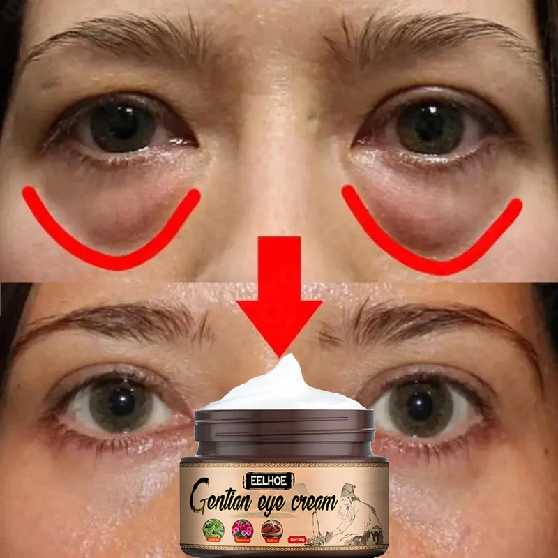 Crème démaquillante instantanée pour les yeux, rétinol, anti-déformable, lifting, raffermissement de la peau, décoloration, ligne fine, anti-cernes, poches, éclaircissant, soins