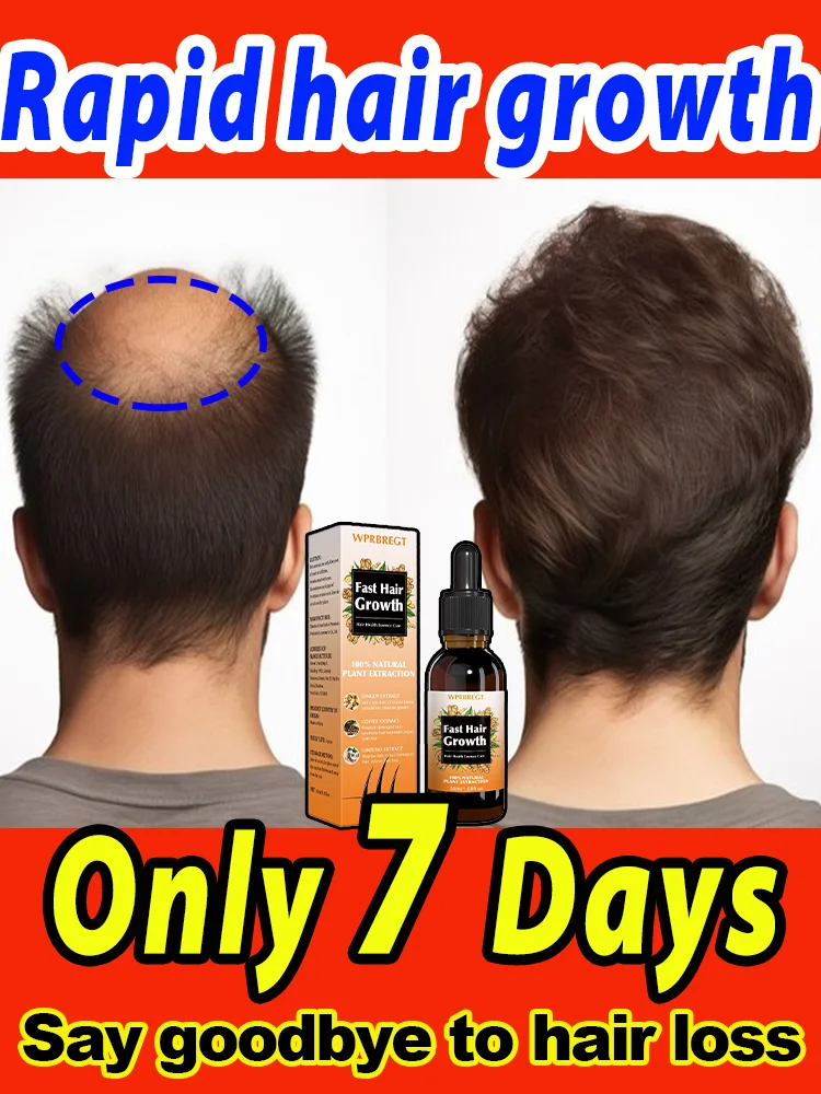 Say goodbye to baldness, hair volume increases dramatically in 3 days，The effect is comparable to hair ᴛʀᴀɴsᴘʟᴀɴᴛᴀᴛɪᴏɴ