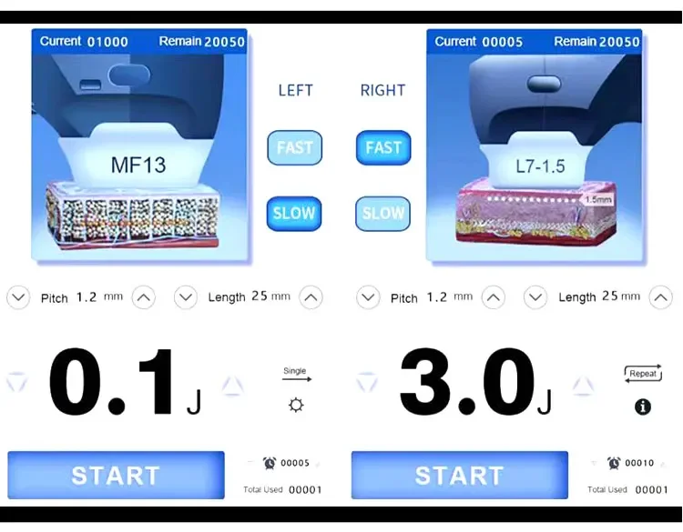 Мини 7d устройство для подтяжки лица против морщин