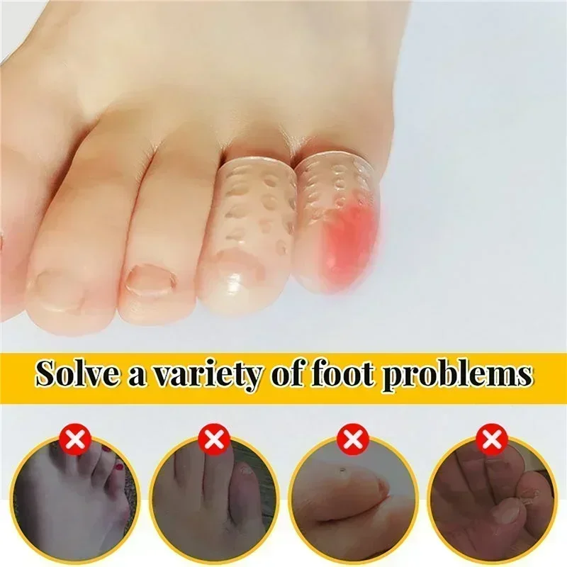 30pcs Transparent Silicone Toe Caps Anti-Friction Breathable Toe Protector Prevents Blisters Toe Caps Cover Protectors Foot Care