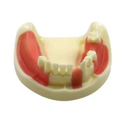 Dental Lower Jaw Implant Practice Model Dentist Educational Student Teeth Practice Model