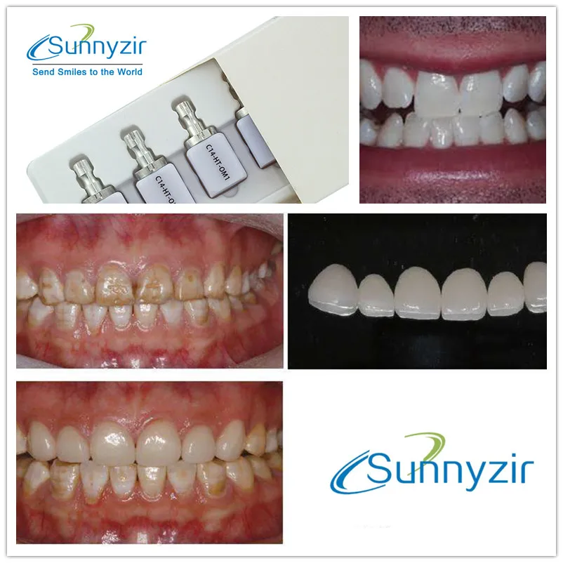 Sunnyzir E.max Cerec CAD litowe szkło disilikatowe-ceramiczne bloki w laboratorium dentystyczne CEREC CAD CAM bloki Vita16 odcienie dostępne