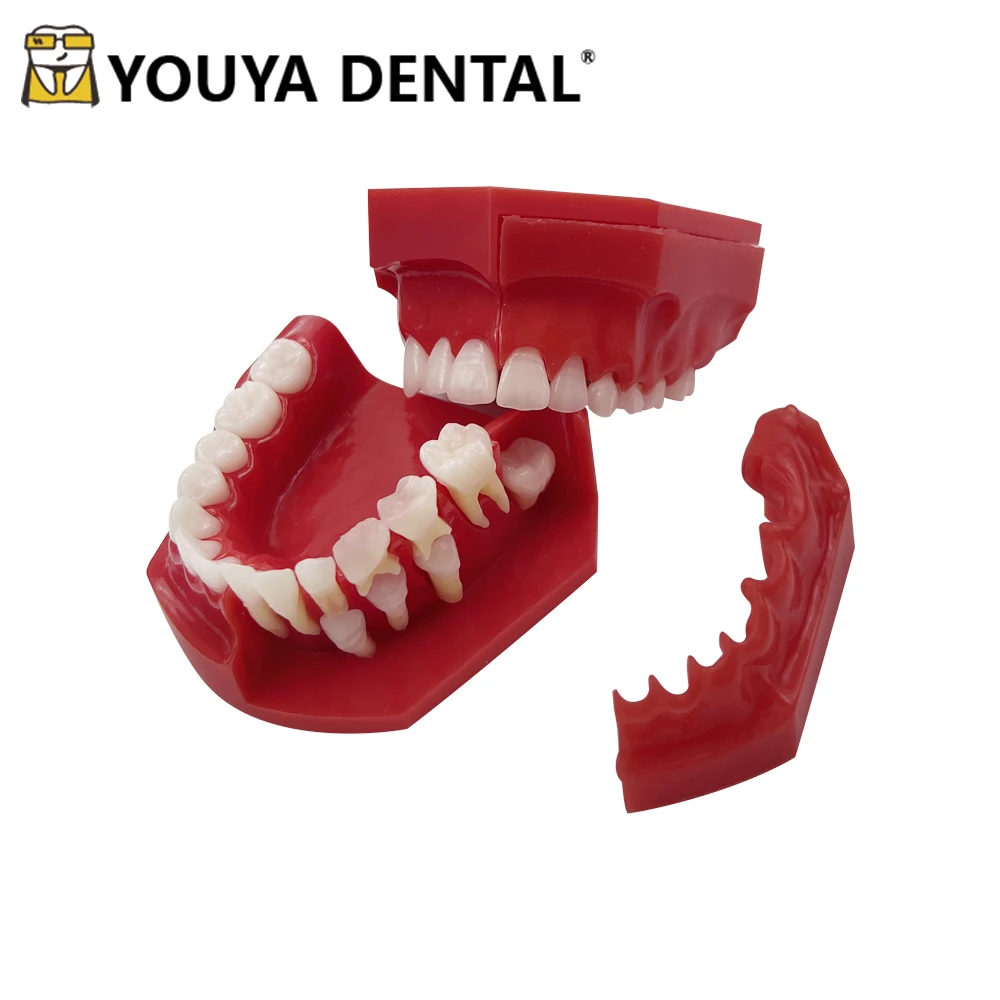 Removable Dental Teaching Model Children's Deciduous Tooth Model For Dentist Student Studying Practice Training