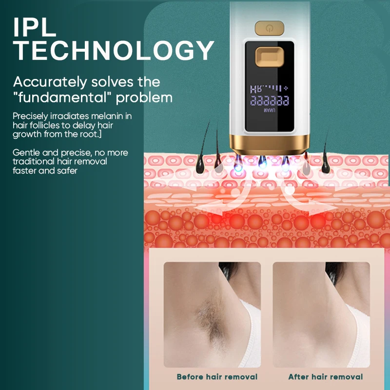 Portable Laser Epilator 999900 Flashes Permanent IPL Hair Removal 3 Light-out Window Painless Hair Remove Home Used IPL Epilator view 5