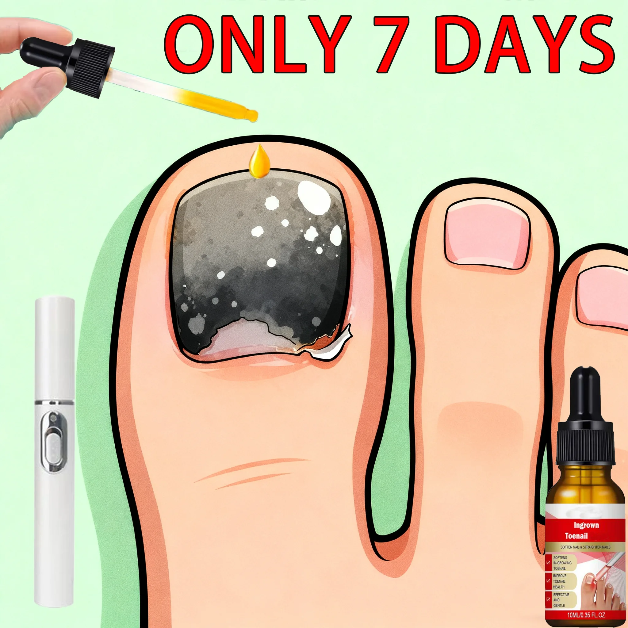 

Инструменты для чистки ногтей Лазерное оборудование для ремонта ногтей, синий свет 470 и 910 нм, инструменты для ухода за ногтями