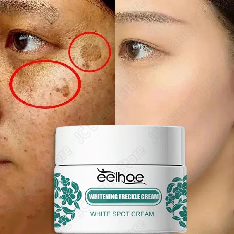 Potente crema blanqueadora de hierbas para pecas, elimina el acné, manchas oscuras, Melasma, antipigmentación, mejora la luminosidad, cuidado facial