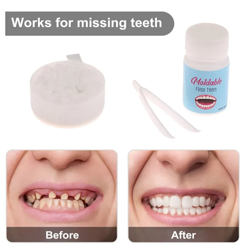 5g/10g/15g Dental Resin Shapeable Teeth Glue Makeup Dentures Modification Temporary Filling Teeth Repair Broken Teeth Tooth Gaps