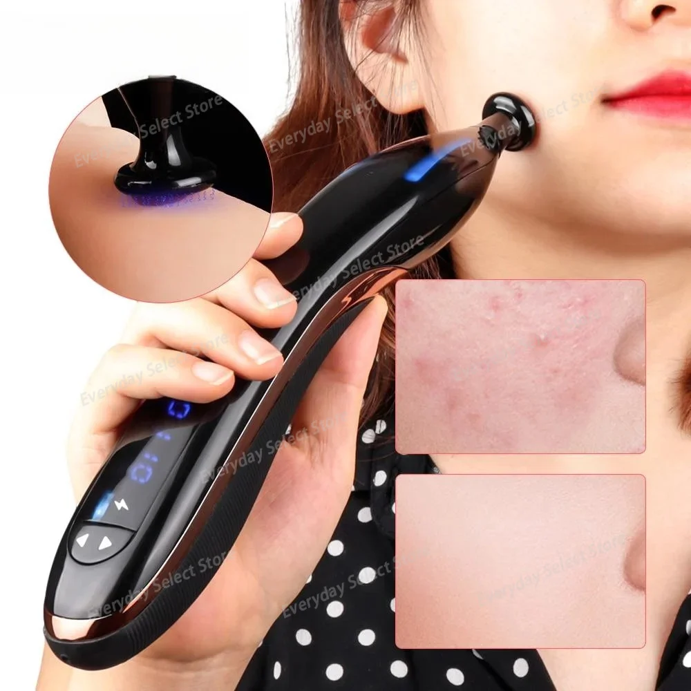 Plasma Non‑contact Acne Beauty Device, Household High Frequency Electrotherapy Facial Ozone plasma beauty Instrument