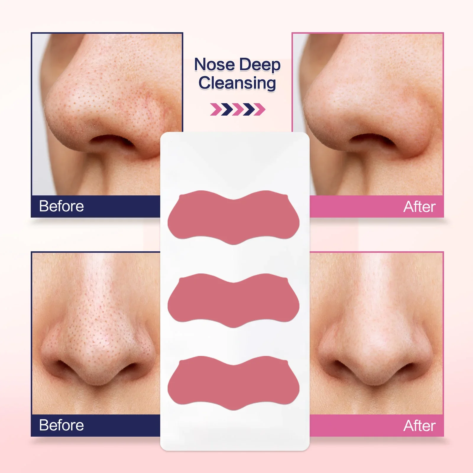 3 szt./pudełko Paski na zaskórniki różowe/czarne Głęboko oczyszczające naklejki na nos do pielęgnacji twarzy Maska na nos Shill na trądzik i zaskórniki