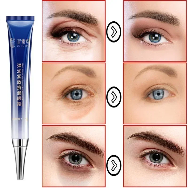 

Remove Eye Fat Granule Cream Particle Firm Anti Wrinkle Serum Eye Bag Puffy Improve Dark Circles Anti Aging Eye Cream