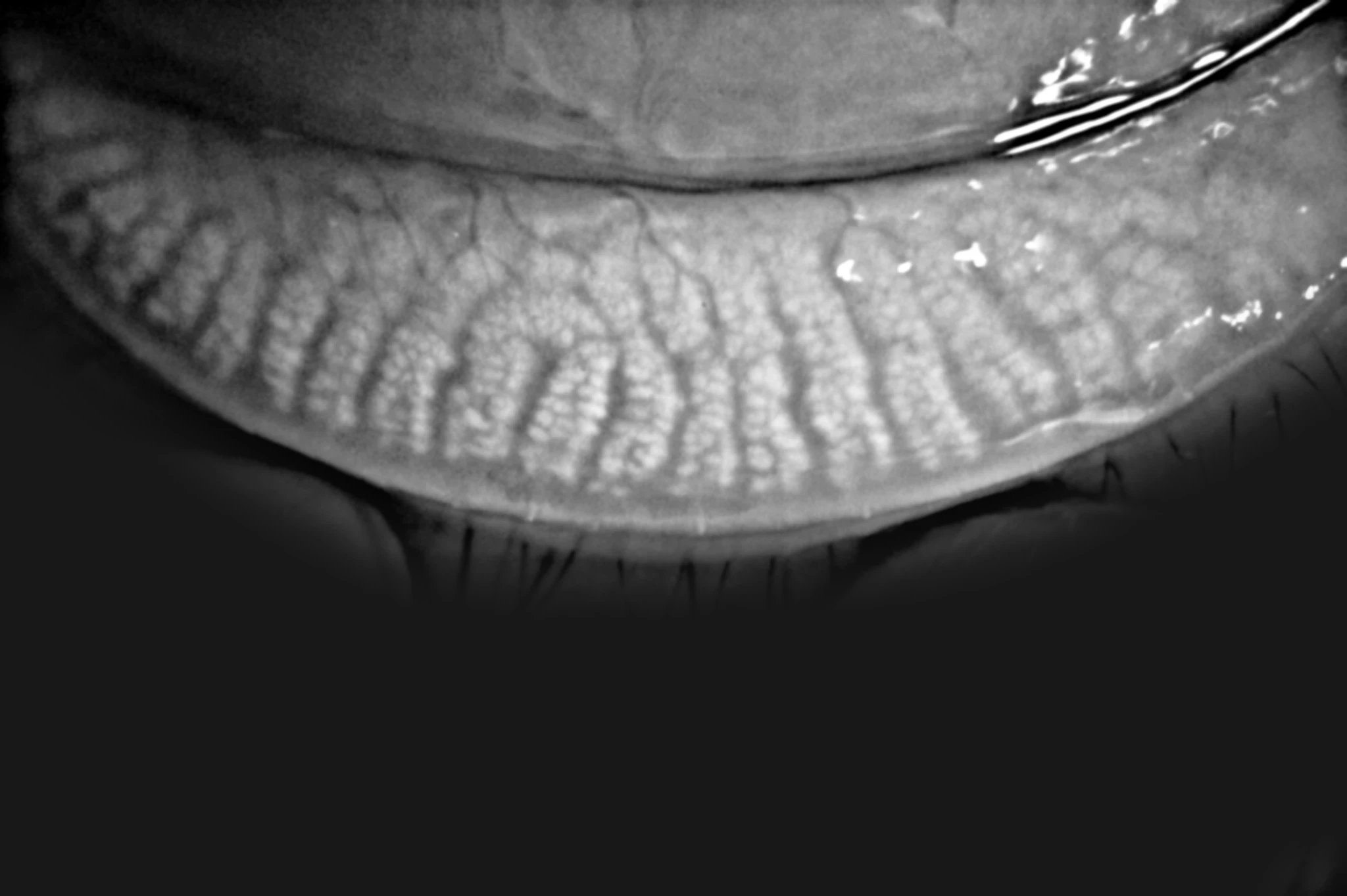 Kanghua Dry Eye Analyzer with Photo Slit Lamp for Meibomian Gland Analysis