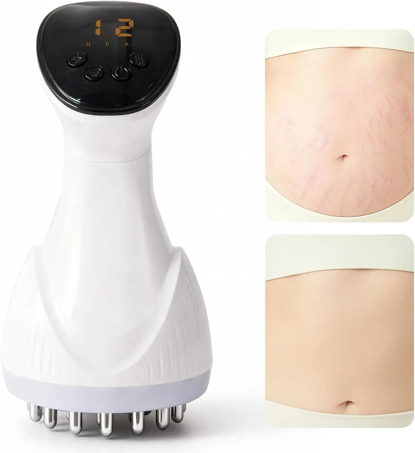 

Portable Body Massager with Heat & Vibration for Legs, Arms, Stomach - Supports Smoother Skin