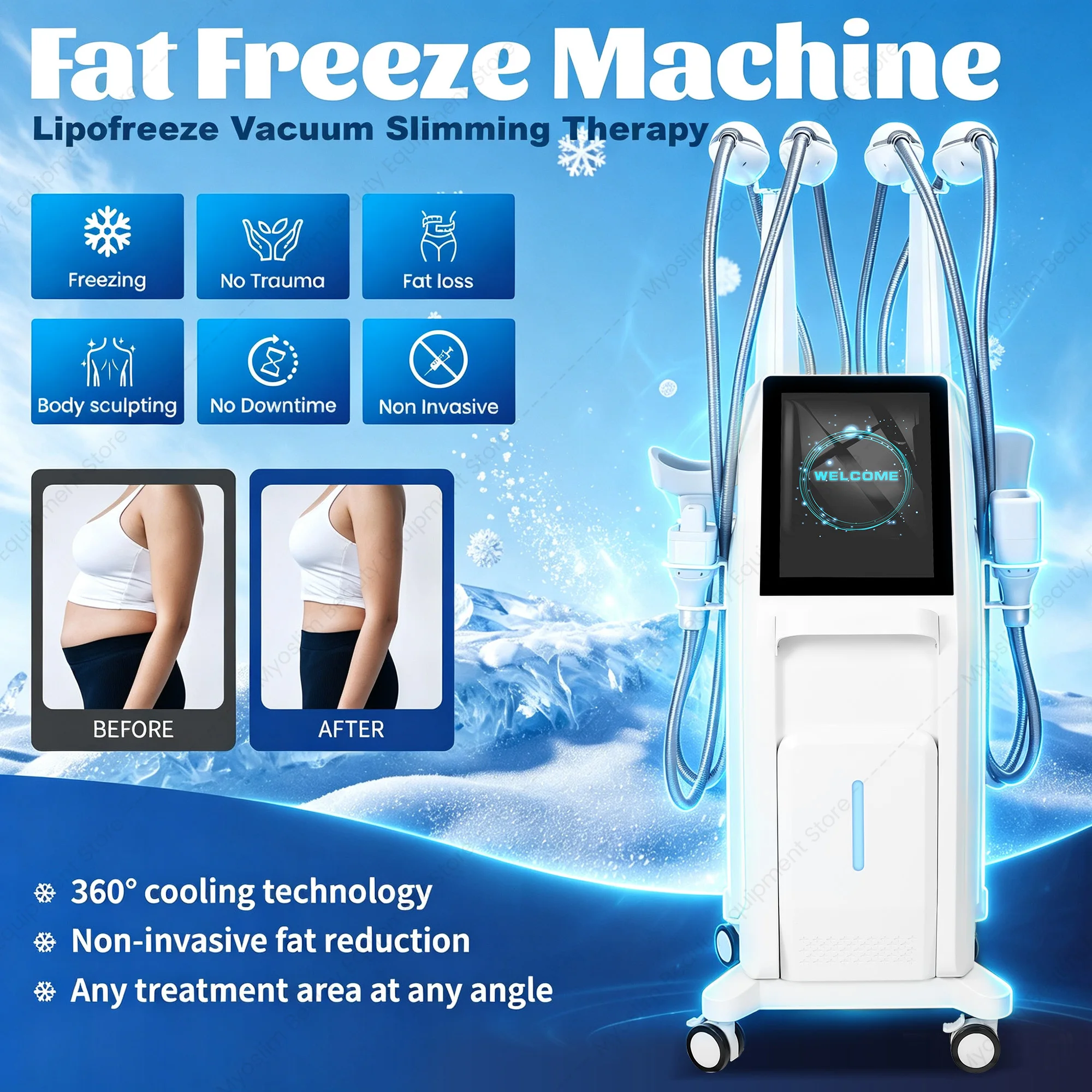Fat Freezing Machine Cryo Body Contouring Device 4 Independent Handles 360° Cooling for Abdomen Waist Thighs Double Chin