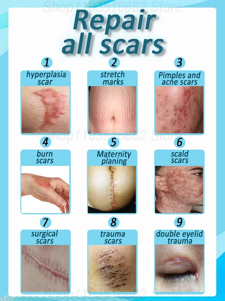 Hot Selling Laser Repair Skin Scars