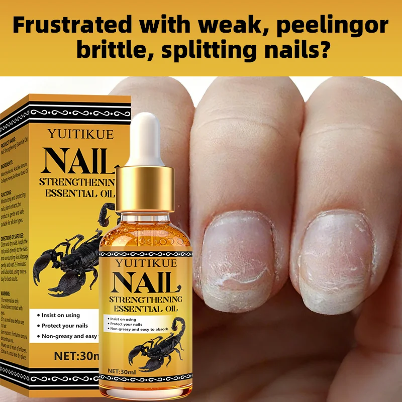 30ml 손톱 강화 오일 - 부서지기 쉬운 손톱, 벗겨짐 및 갈라짐을 수리하고, 보습, 강화 및 보호, 빠른 흡수